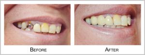 partient1before_after