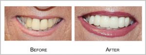 partient3before_after