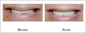 partient5before_after