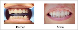 partient7before_after