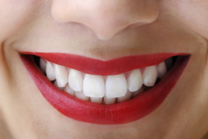 istock_000019355835medium