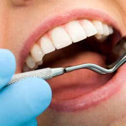 Mouth care Close-up of female with open mouth during oral checkup at the dentists